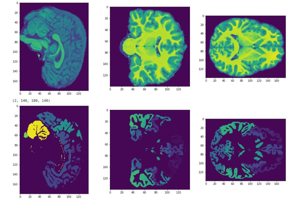 Skoltech desenvolveu um novo método para determinar a inteligência das crianças por ressonância magnética cerebral