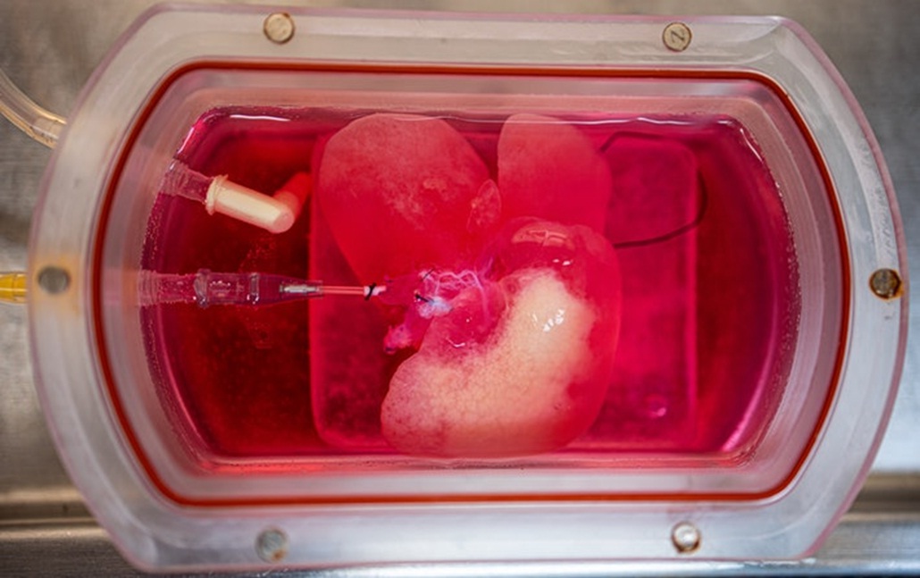 Scientists have grown the liver from human skin cells and successfully transplanted it